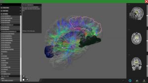 Desktop - realtime reconstruction and visualization of medical data