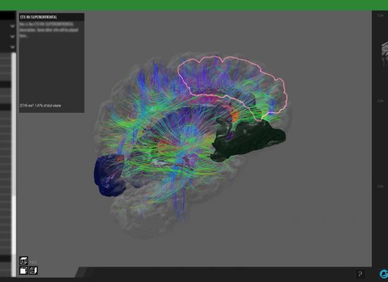 Desktop - realtime reconstruction and visualization of medical data